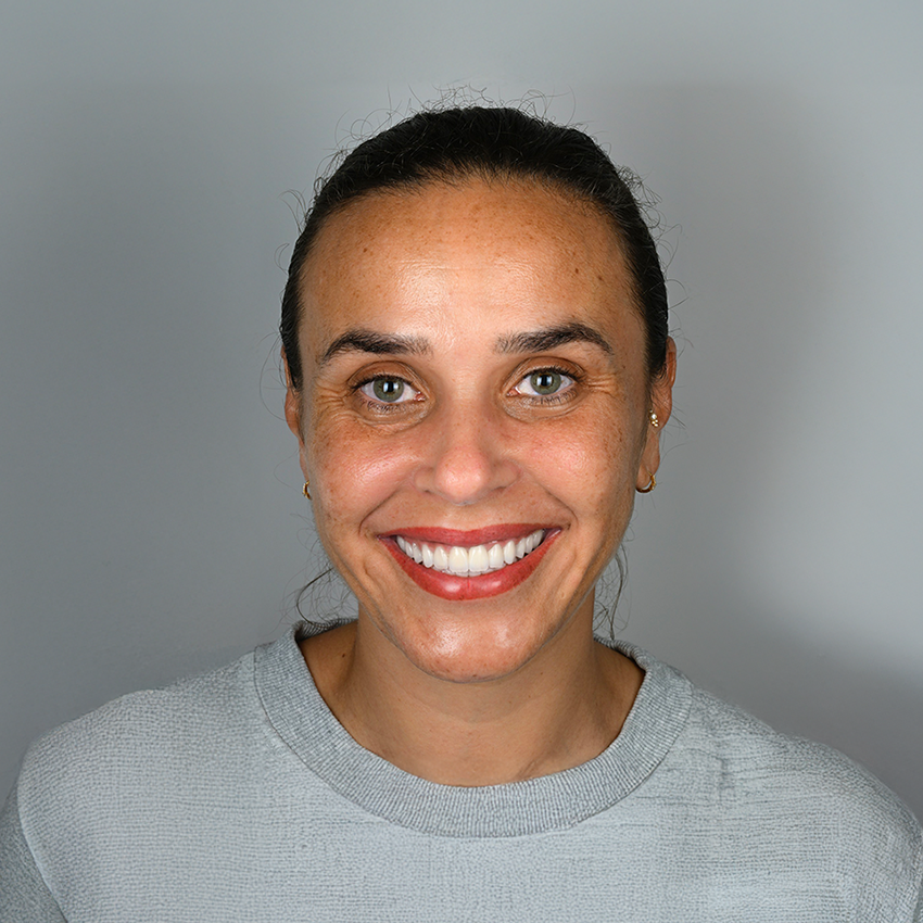 Dental Implant Patient Photo