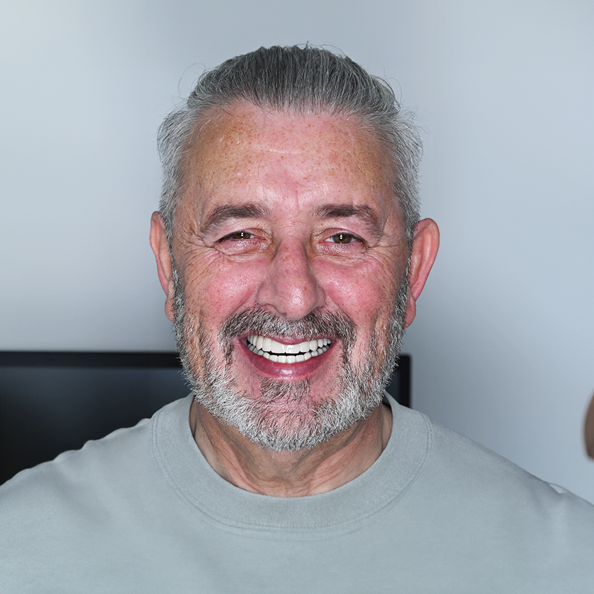 Dental Implant Patient Photo